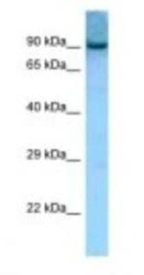 Western Blot: Acetoacetyl CoA synthetase Antibody [NBP1-98459]