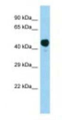 Western Blot: Acetoacetyl CoA synthetase Antibody [NBP1-98507]