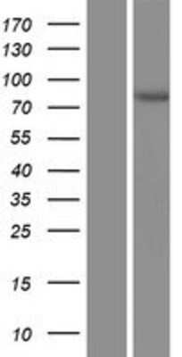 Western Blot: Acetoacetyl CoA synthetase Overexpression Lysate [NBP2-06369]