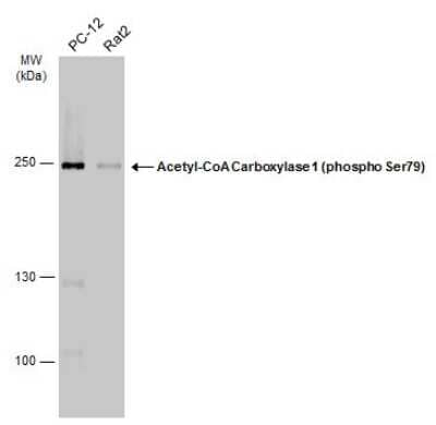 Western Blot: Acetyl-CoA Carboxylase alpha/ACACA [p Ser79] Antibody [NBP3-13324]