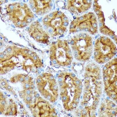 Immunohistochemistry-Paraffin: Acetyl-CoA Carboxylase alpha/ACACA Antibody (5J4W7) [NBP3-15744]