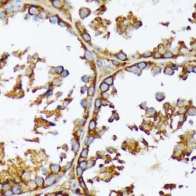 Immunohistochemistry-Paraffin: Acetyl-CoA Carboxylase alpha/ACACA Antibody (5J4W7) [NBP3-15744]