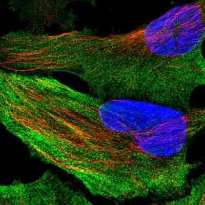 Immunocytochemistry/ Immunofluorescence: Acetyl-CoA Carboxylase alpha/ACACA Antibody [NBP2-55439]