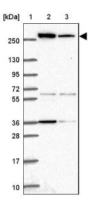 Western Blot: Acetyl-CoA Carboxylase alpha/ACACA Antibody [NBP2-38981]