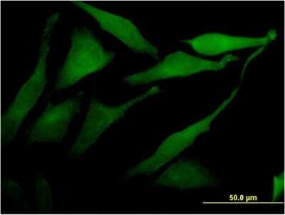 Immunocytochemistry/ Immunofluorescence: Acetyl CoA synthetase Antibody (2A10) [H00055902-M09]