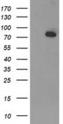 Western Blot: Acetyl CoA synthetase Antibody (OTI3H4) [NBP2-01269]