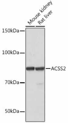 Western Blot: Acetyl CoA synthetase Antibody (4N5V4) [NBP3-15447]