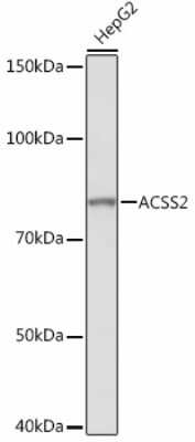 Western Blot: Acetyl CoA synthetase Antibody (4N5V4) [NBP3-15447]