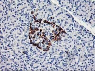 Immunohistochemistry: Acetyl CoA synthetase Antibody (OTI3H4) - Azide and BSA Free [NBP2-72039]