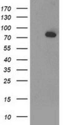 Western Blot: Acetyl CoA synthetase Antibody (OTI3H4)Azide and BSA Free [NBP2-72039]