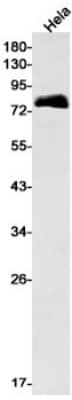 Western Blot: Acetyl CoA synthetase Antibody (S01-7I6) [NBP3-19941]