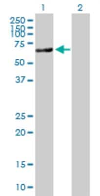 Western Blot: Acetyl CoA synthetase Antibody [H00055902-B01P]