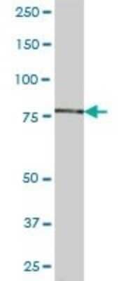 Western Blot: Acetyl CoA synthetase Antibody [H00055902-B01P]