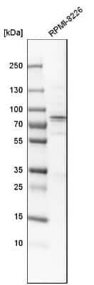 Western Blot: Acetyl CoA synthetase Antibody [NBP1-90276]