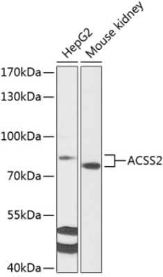 Western Blot: Acetyl CoA synthetase AntibodyBSA Free [NBP3-15466]