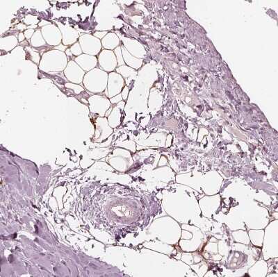Immunohistochemistry-Paraffin: Acetyl Coenzyme A Carboxylase Beta Antibody [NBP1-90274]