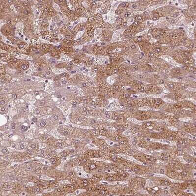 Immunohistochemistry-Paraffin: Acetyl Coenzyme A Carboxylase Beta Antibody [NBP1-90274]