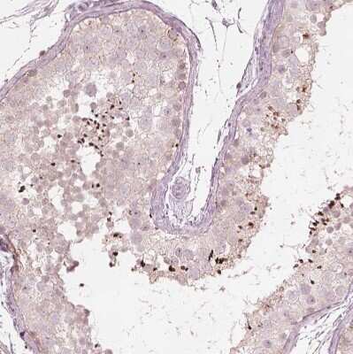 Immunohistochemistry-Paraffin: Acetyl Coenzyme A Carboxylase Beta Antibody [NBP1-90274]