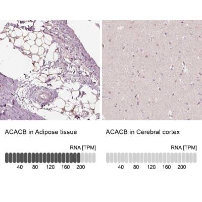 Immunohistochemistry-Paraffin: Acetyl Coenzyme A Carboxylase Beta Antibody [NBP1-90274]