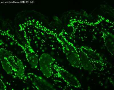 Immunohistochemistry: Acetyl-Lysine Antibody (7F8) [NB110-96876]