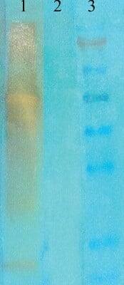 Western Blot: Acetyl-Lysine Antibody (7F8) [NB110-96876]