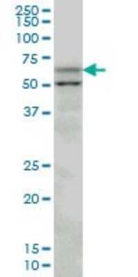 Western Blot: Acetyl-coenzyme A transporter 1 Antibody (3A4) [H00009197-M07]