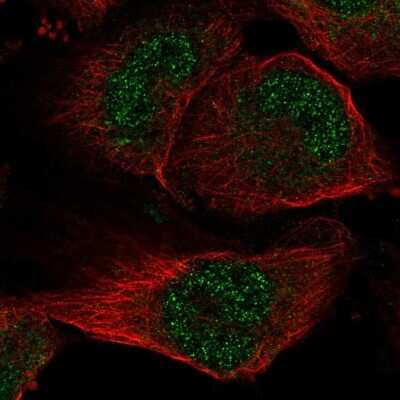 Immunocytochemistry/ Immunofluorescence: Acetyl-coenzyme A transporter 1 Antibody [NBP2-68761]