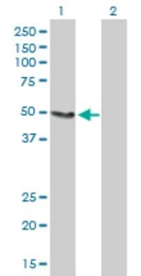 Western Blot: Acetyl-coenzyme A transporter 1 Antibody [H00009197-B01P]