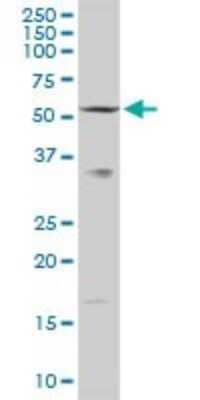 Western Blot: Acetyl-coenzyme A transporter 1 Antibody [H00009197-D01P]