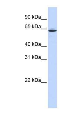 Western Blot: Acetyl-coenzyme A transporter 1 Antibody [NBP1-59882]