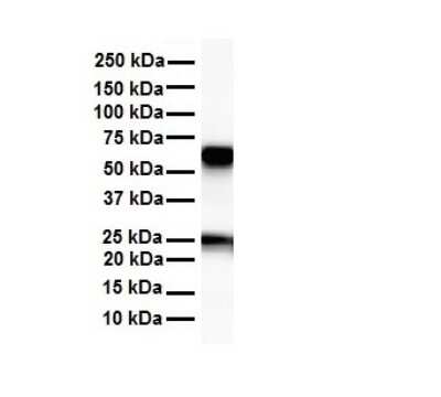 Western Blot: Acetyl-coenzyme A transporter 1 Antibody [NBP1-59882]
