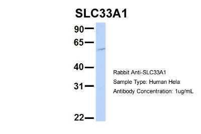 Western Blot: Acetyl-coenzyme A transporter 1 Antibody [NBP1-59882]