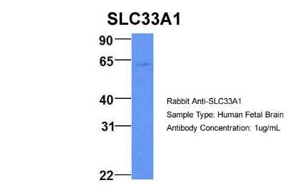 Western Blot: Acetyl-coenzyme A transporter 1 Antibody [NBP1-59882]