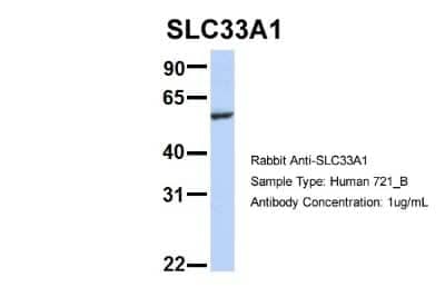 Western Blot: Acetyl-coenzyme A transporter 1 Antibody [NBP1-59882]