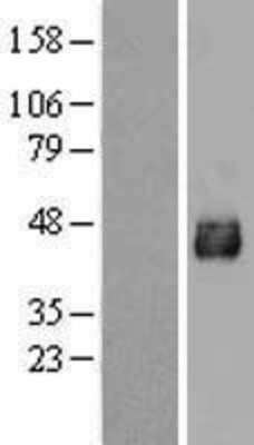 Western Blot: Acetyl-coenzyme A transporter 1 Overexpression Lysate [NBP2-04277]