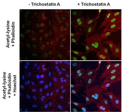 Immunocytochemistry/ Immunofluorescence: Acetyl-Lysine Antibody (1C6) [NB100-74339]
