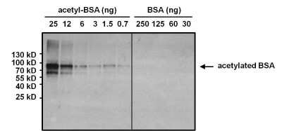 Western Blot: Acetyl-Lysine Antibody (1C6) [NB100-74339]
