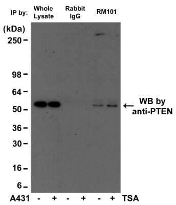 Immunoprecipitation: Acetyl-Lysine Antibody (RM101) [NBP2-77397]