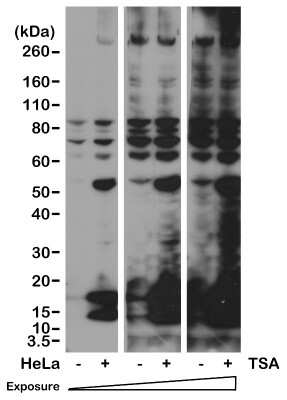 Western Blot: Acetyl-Lysine Antibody (RM101) [NBP2-77397]