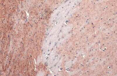 Immunohistochemistry-Paraffin: Acetylcholinesterase/ACHE Antibody (HL1102) [NBP3-13720]