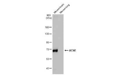 Western Blot: Acetylcholinesterase/ACHE Antibody (HL1102) [NBP3-13720]