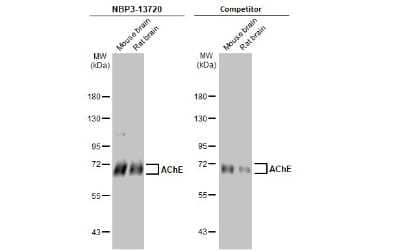 Western Blot: Acetylcholinesterase/ACHE Antibody (HL1102) [NBP3-13720]