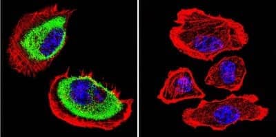 Immunocytochemistry/ Immunofluorescence: Acetylcholinesterase/ACHE Antibody (HR2) - BSA Free [NB300-528]