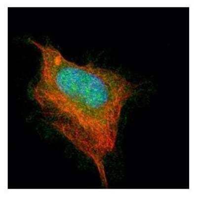 Immunocytochemistry/ Immunofluorescence: Acetylcholinesterase/ACHE Antibody [NBP1-31329]