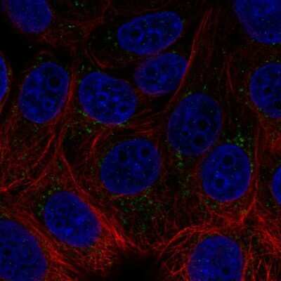 Immunocytochemistry/ Immunofluorescence: Acetylcholinesterase/ACHE Antibody [NBP2-55516]