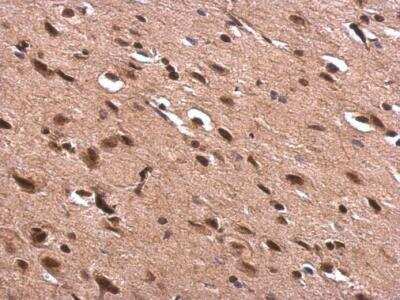 Immunohistochemistry-Paraffin: Acetylcholinesterase/ACHE Antibody [NBP1-31329]