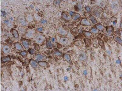 Immunohistochemistry-Paraffin: Acetylcholinesterase/ACHE Antibody [NBP1-31329]
