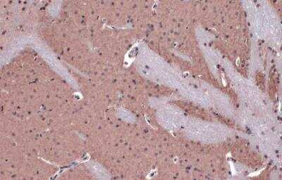 Immunohistochemistry-Paraffin: Acetylcholinesterase/ACHE Antibody [NBP1-31329]