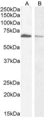 Western Blot: Acetylcholinesterase/ACHE Antibody [NB100-1519]