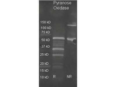 Western Blot: Acetylcholinesterase/ACHE Antibody [NB600-911]